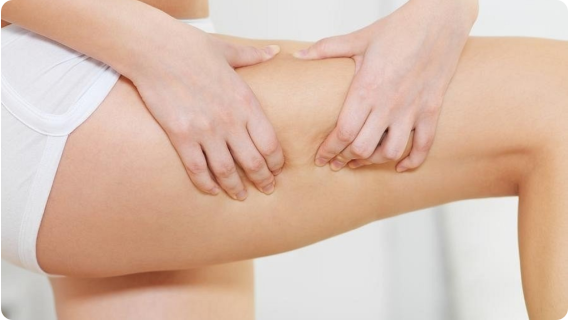 Как да разберете дали задържате течности в тялото си - preview