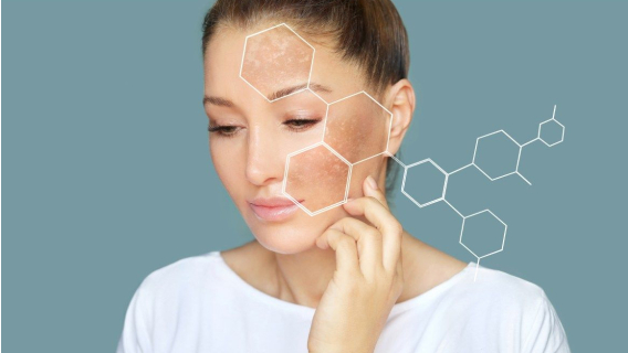 Как да се справим с пигментацията, хиперпигментацията и акнето