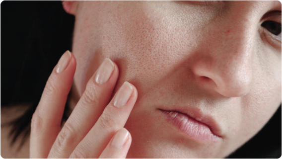 Гъша кожа – що е то и как да се отървем от нея?