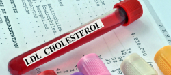 Холестерол