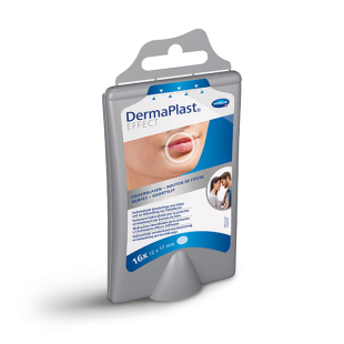 Дермапласт cold sore 17мм/12мм 536840