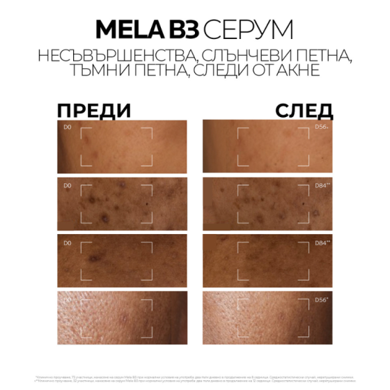La Roche-Posay MELA B3 Интензивен концентриран серум против тъмни петна 30мл. 890021