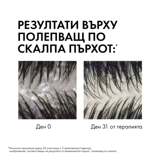 Vichy dercos шампоан против пърхот сух скалп 200мл. 330262