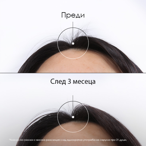 Klorane Quinine Серум против косопад с хинин и органичен еделвайс 100ml