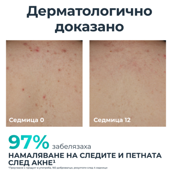Eucerin Dermopure Clinical Коригиращ крем за тяло 200мл
